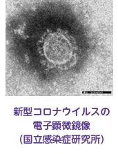 新型コロナウイルスの電子顕微鏡像(国立感染症研究所)